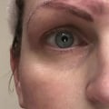 Does retinol fade semi-permanent makeup?