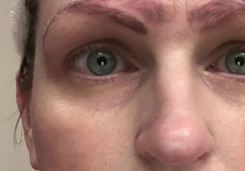 Does retinol fade semi-permanent makeup?
